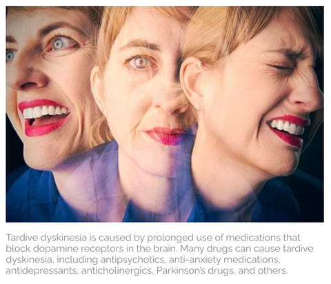 Tardive Dyskinesia ebook